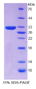 CD109分子(CD109)重组蛋白