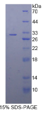 B-淋巴细胞激活抗原B7-2(LAB7-2)重组蛋白