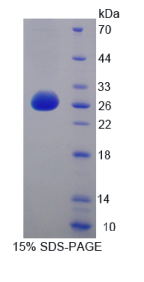 转录激活因子7(ATF7)重组蛋白