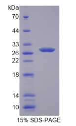 层粘连蛋白β4(LAMβ4)重组蛋白