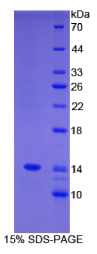 C4结合蛋白α(C4BPα)重组蛋白