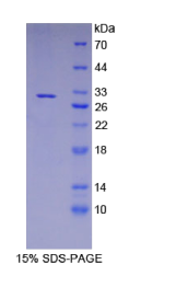 淀粉样蛋白β前体蛋白结合蛋白A3(APBA3)重组蛋白