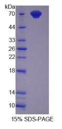 CD4分子(CD4)重组蛋白