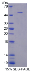 B-淋巴细胞激活抗原B7-1(LAB7-1)重组蛋白