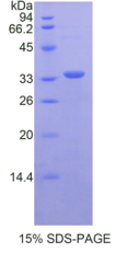 CD163分子(CD163)重组蛋白