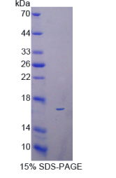 再生胰岛衍生蛋白3β(REG3β)重组蛋白