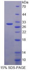 ATP结合盒转运蛋白C3(ABCC3)重组蛋白