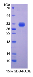 着丝粒蛋白H(CENPH)重组蛋白