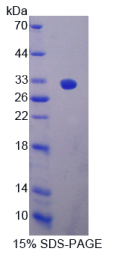 CD163分子(CD163)重组蛋白