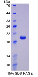 CD160分子(CD160)重组蛋白