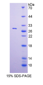 DNA指导聚合酶α1(POLα1)重组蛋白