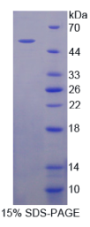 AMP激活蛋白激酶β1(PRKAβ1)重组蛋白