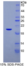 CCAAT增强子结合蛋白γ(CEBPγ)重组蛋白