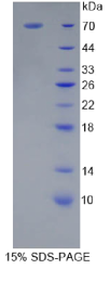 CD14分子(CD14)重组蛋白