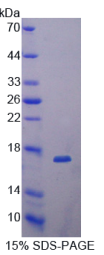 Dickkopf相关蛋白4(DKK4)重组蛋白