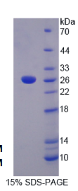 低密度脂蛋白受体相关蛋白3(LRP3)重组蛋白