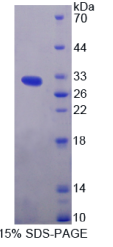 AMP激活蛋白激酶β2(PRKAβ2)重组蛋白