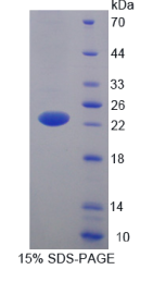 脂质运载蛋白5(LCN5)重组蛋白
