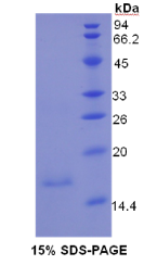 粘蛋白5B(MUC5B)重组蛋白