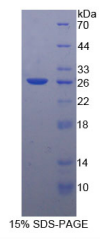 B-细胞淋巴瘤因子2(Bcl2)重组蛋白