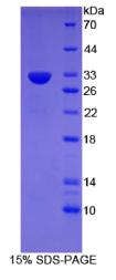 CD109分子(CD109)重组蛋白