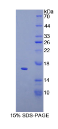 CD160分子(CD160)重组蛋白