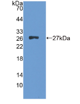 前梯度蛋白2(AGR2)重组蛋白