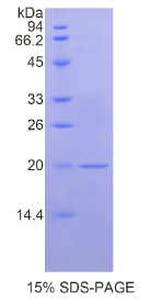 CD14分子(CD14)重组蛋白