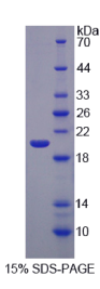 真核翻译起始因子2α激酶3(EIF2αK3)重组蛋白