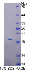 Metaxin 1蛋白(MTX1)重组蛋白