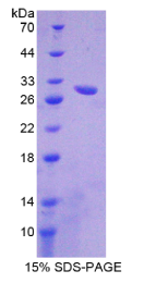 ATP结合盒转运蛋白C11(ABCC11)重组蛋白