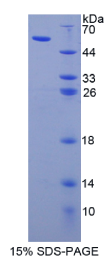 载脂蛋白L1(APOL1)重组蛋白