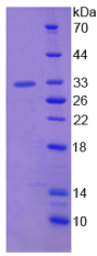 ATP结合盒转运蛋白C8(ABCC8)重组蛋白