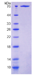 PP2A癌症抑制抑制因子(CIP2A)重组蛋白