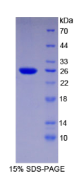 转运蛋白1(TNPO1)重组蛋白