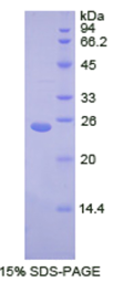 转运蛋白1(TNPO1)重组蛋白