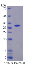 蛋白酶体亚基β6(PSMβ6)重组蛋白