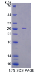 F-框蛋白32(FBXO32)重组蛋白
