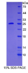 Bcl2/腺病毒E1B相互作用蛋白3(BNIP3)重组蛋白
