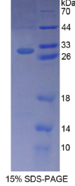B-细胞淋巴瘤因子10(Bcl10)重组蛋白