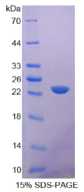 CD6分子(CD6)重组蛋白