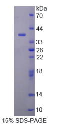 肿瘤关联钙信号转导子2(TACSTD2)重组蛋白