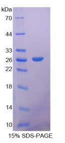 成纤维细胞生长因子21(FGF21)重组蛋白
