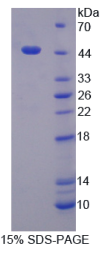 G蛋白α11(GNα11)重组蛋白