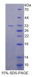 B-细胞淋巴瘤因子11A(Bcl11A)重组蛋白