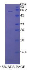 CD5抗原样蛋白(CD5L)重组蛋白