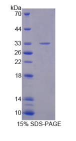 淀粉样蛋白β前体蛋白结合蛋白B3(APBB3)重组蛋白