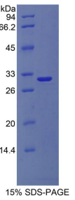 Ⅳ型胶原α1(COL4α1)重组蛋白