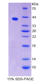 防御素β1(DEFβ1)重组蛋白