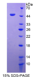 粘附调节分子1(ADRM1)重组蛋白